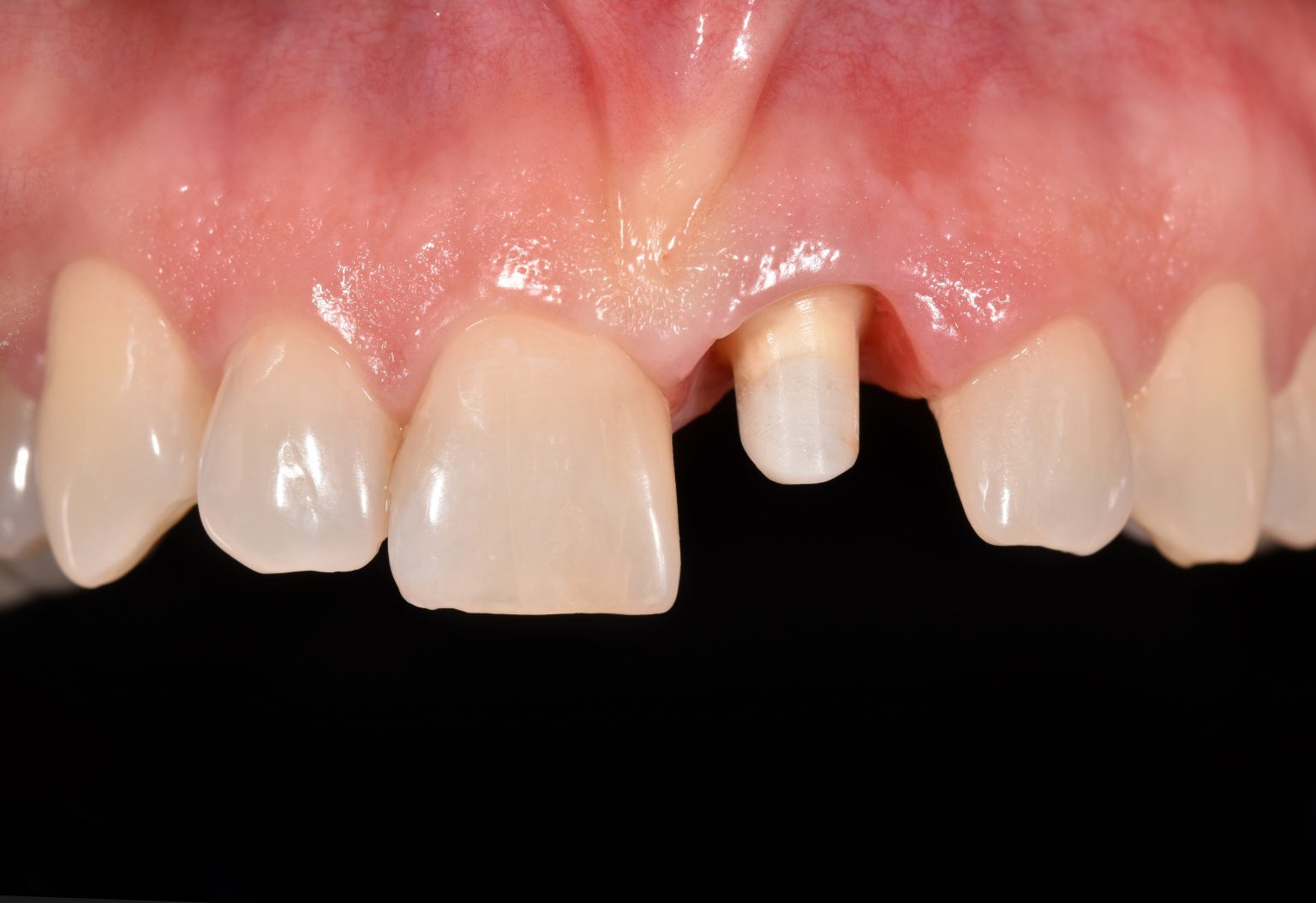 Füllungen • Kronen • Brücken ZAHNARZTPRAXIS GERNER & NOETZEL